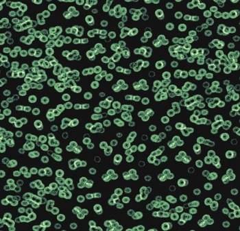 Wykładzina dywanowe FORBO 990102 Bacteria Flotex Z Nadrukiem Cyfrowym - Rolka - 4.3  mm