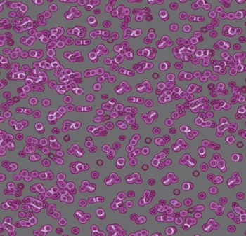Wykładzina dywanowe FORBO 990301 Bacteria Flotex Z Nadrukiem Cyfrowym - Rolka - 4.3  mm