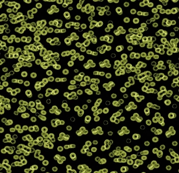 Wykładzina dywanowe FORBO 990103FR Bacteria Flotex Vision Fr Biblioteka Cyfrowa - Rolka - 3.3  mm